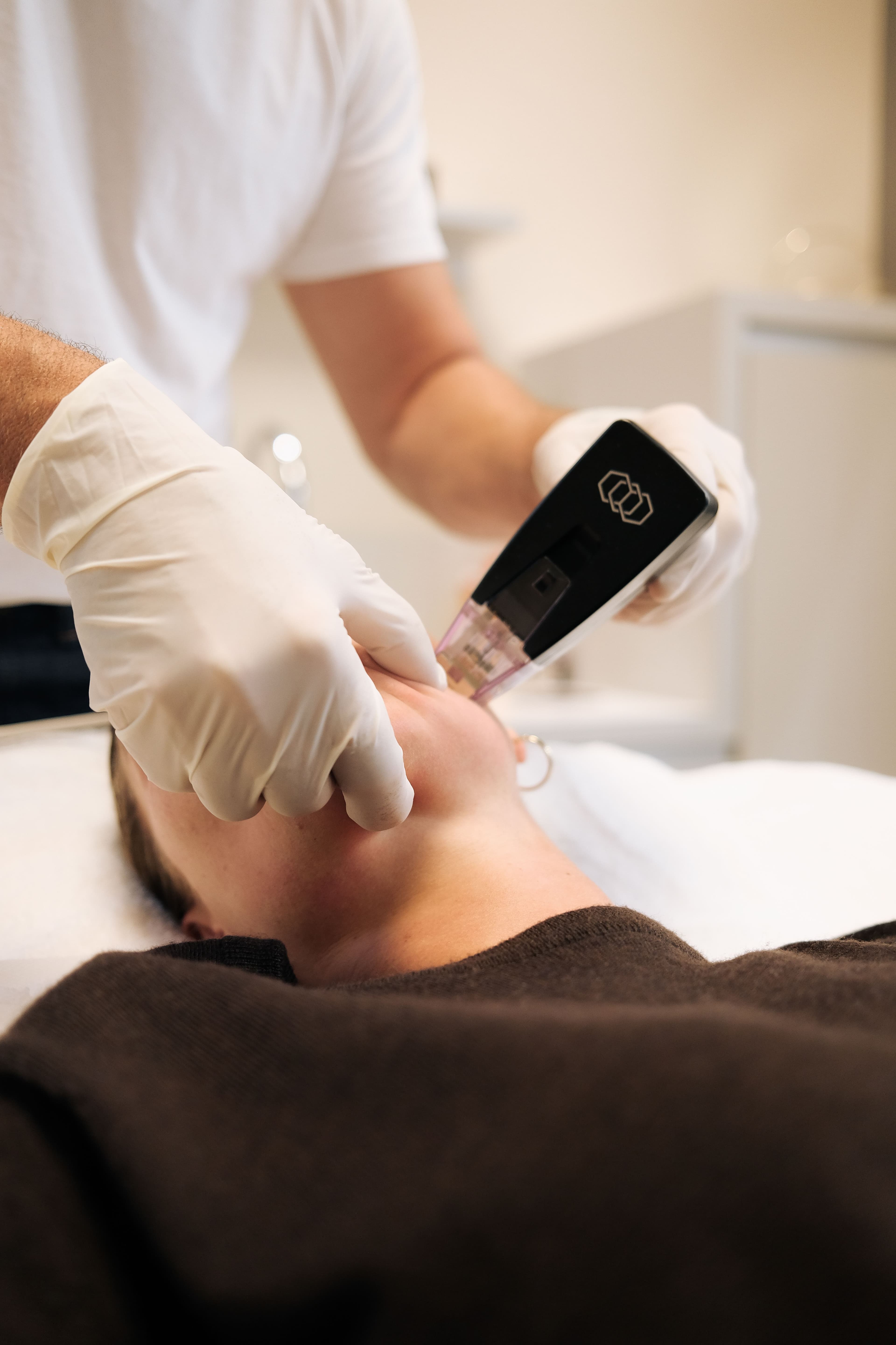 Arzt führt Morpheus8 Behandlung im Gesicht durch, Radiofrequenz-Microneedling in der Metropolitan Clinic